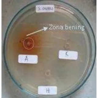 Gambar 5) dan daya hambat kloramfenikol 