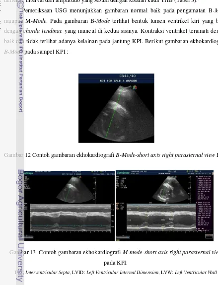 Gambar 12 Contoh gambaran ekhokardiografi B-Mode-short axis right parasternal view KPI