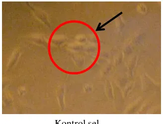 Gambar 7 Sel uji T47D tanpa perlakuan ekstrak kasar (sel normal T47D ditunjukkan dalam lingkaran merah)