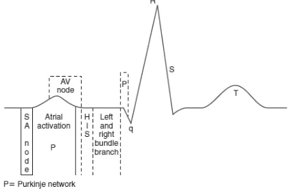 Figure 7.  An ECG wave. Taken from Khan  (2008)5