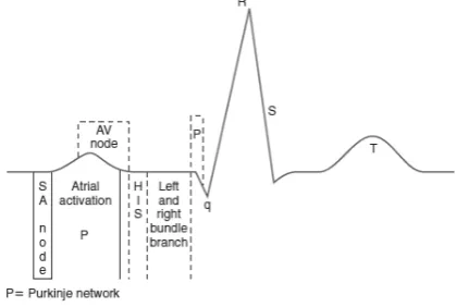 Figure 7.  An ECG wave. Taken from Khan  (2008)5