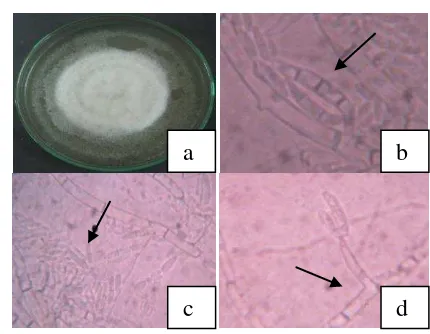 Gambar 5 Fusarium oxysporum:  (a) pada media PDA umur 7 hari, (b) 