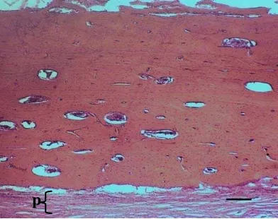 Gambar 21  Gambaran mikroskopis daerah defek tulang tibia kontrol selama 60 hari pascaoperasi, yang memperlihatkan struktur tulang baru yang terdiri atas: os = osteosit, h = saluran Havers, dan m = matriks tulang