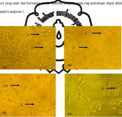 Gambar 8. Kenampakan morfologi sel HeLa pada perbesaran 100x setelah penambahan isolat rumput mutiara pada perlakuan (a) Isolat 4 konsentrasi 200 µg/ml, (b) Isolat 5 konsentrasi 200 µg/ml, (c) doxorubixin konsentrasi 10 µg/ml, (d) kontrol sel