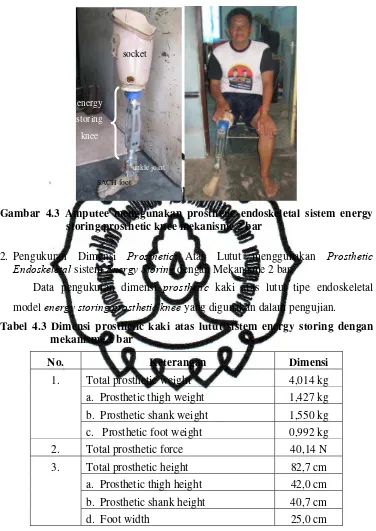 Gambar 4.3 Amputee menggunakan prosthetic endoskeletal sistem energy 