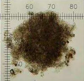 Gambar 5.  Floc yang dibentuk oleh bakteri tertentu yang dapat dimanfaatkan sebagai pakan tambahan udang windu (Anonim, 2010) 