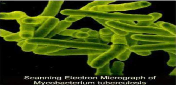 Gambar 2.1 Electron Micrograph of Mycobacterium Tuberculosis 