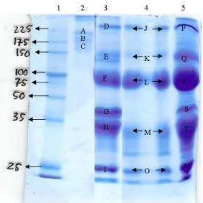 Gambar 5. Profil pBlue. KeKol III Sppita protein hasil SDS4PAGE dengan pewarnaan Ce. Ket: 1: Marker, 2: IgG kontrol, 3: Kol II Sp4, 4: Kol Sp4