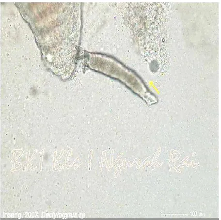 Gambar 4. Kista Dactylogyrus sp. di dalam sel-sel epitelia yang hiperplastik pada lamela primer insang (H & E, 1000x.)
