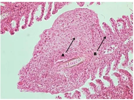 Gambar 5. Anchor Dactylogyrus sp. yang melekat pada lamela insang (A) dan  hiperplasia sel-sel epitelia lamela  insang  (B) (H & E, 1000x.).