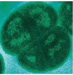 Gambar 2  Bakteri Deinococcus radiodurans (Encyclopedia of Alternative Energy 