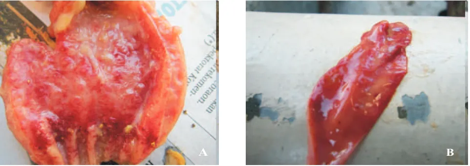 Gambar 1. Nekrosis hemoragik pada proventrikulus (A) dan usus halus  (B)