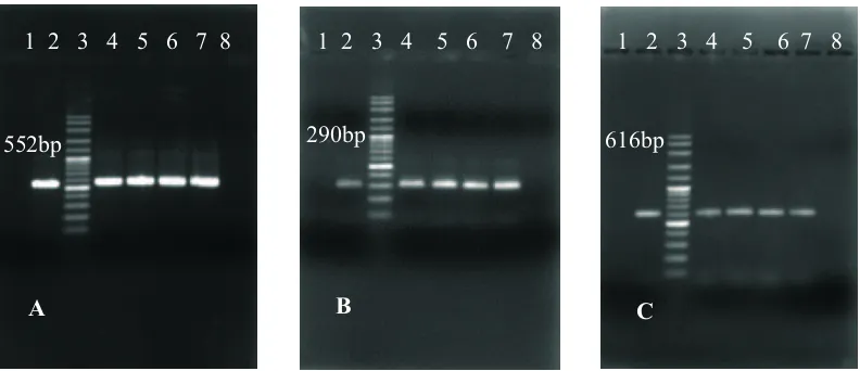Fig. 2. One tube RT-PCR run on 1.5% agarose gel electrophoresis for AIV NP of 552 bp gene (A) for AIV H5 of 290 bp gene (B) and for AIV N1 of 616 bp gene (C) in the whole bodies the flies