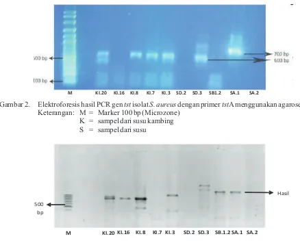 Gambar 2. Elektroforesis hasil PCR gen tst isolat S. aureus dengan primer tstA menggunakan agarose 1,5%