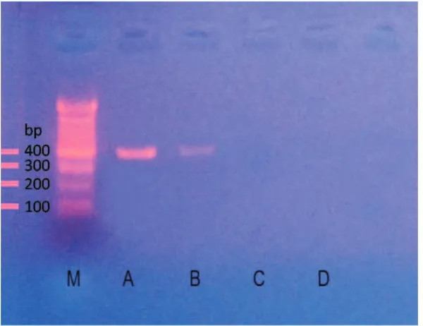 Gambar 1. Hasil amplifikasi DNA Campylobacter jejuni.