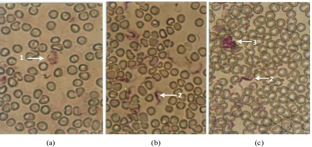 Gambar 1:  Trypanosoma evansi dalam darah mencit pada hari ke-4.  (a) Kontrol negatif; (b)Kontrol positif (yang diinfeksi T.evansi); (c) Perlakuan dengan ekstrak spons Hymeniacidonsp, konsentrasi 400 mg/Kg BB PewarnaanGiemsa, perbesaran10x 100) Ket: 1