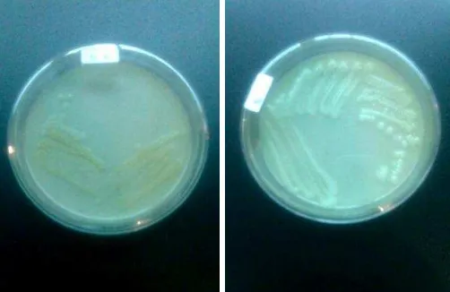 Gambar 10. Isolat bakteri berwarna kuning dan isolat bakteri berwarna kream 