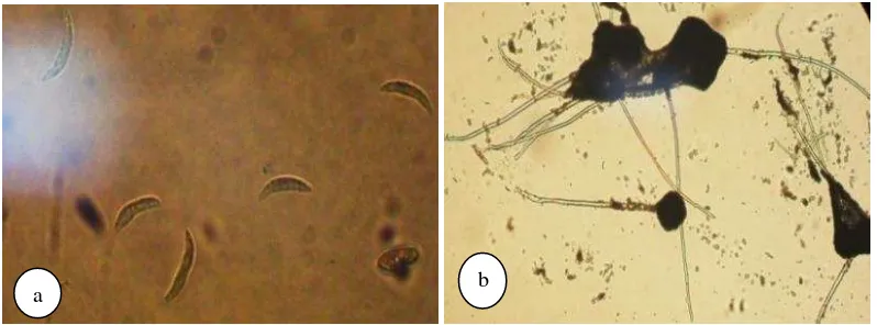 Gambar 13. Konidia Colletotrichum sp. (a) dan Mucor sp. (b) 