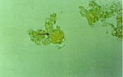 Gambar 1. Sista Toxoplasma gondii berbentuk bundar dengan tepi yang sangat jelas.