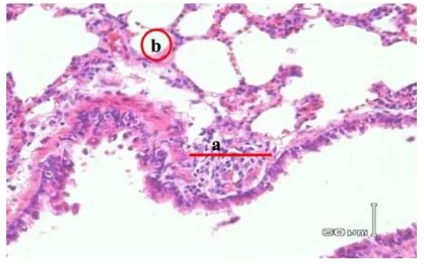 Gambar 1. Gambaran histopatologis parenkima paru-paru tikus putih kelompok kontrol (K I)