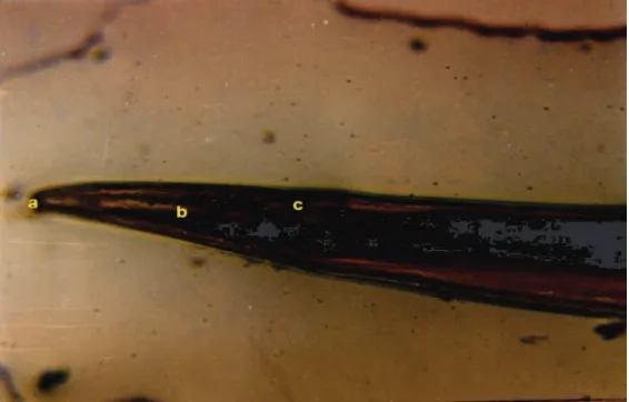 Gambar 1.  Ujung anterior Hemonchus contortus dewasa: a. mulut, b. esophagus, c. papilla servikalis