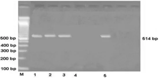 Gambar 1. Hasil elektroforesis produk RT-PCR. A. Hasil elektroforesis gen H5 pada 545 bp