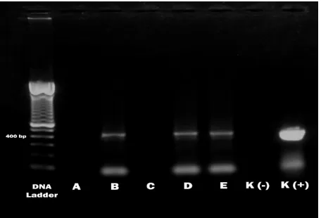 Gambar 1. Hasil elektroforesis RT-PCR fragmen VP-2 gene virus IBD, teramati pita DNA pada posisi 440 bp