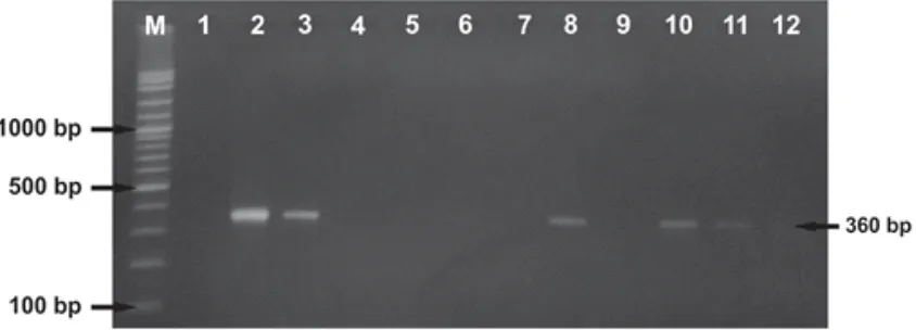 Gambar 3. Gel elektroforesis hasil PCR gen tetK (M= marker, sumuran 1-2 kontrol ATCC dan MRSA, sumuran 3-12 isolat S