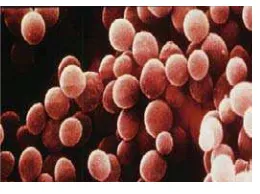 Gambar 2.Staphylococcus aureus (Todar, 2008)  