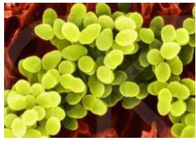Gambar 3  Sumber: www.jpnn.com. Escherichia coli. 