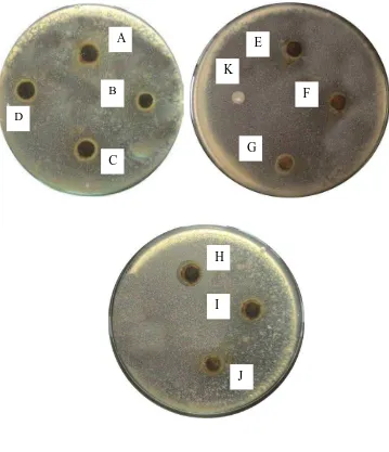 Gambar pengujian aktivitas antibakteri fraksi Lactobacillus acidophillus 
