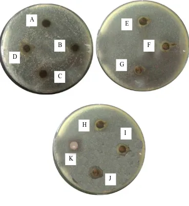 Gambar pengujian aktivitas antibakteri fraksi terhadap Vibrio cholera 