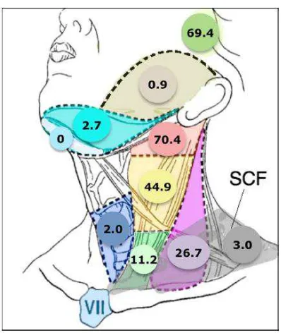 Gambar 2.13. Metastatis karsinoma nasofaring pada kelenjar getah bening. A. Gambaran sitologi biopsi aspirasi KGB menunjukkan kelompokan sel-sel tumor di antara sel-sel limfosit matur