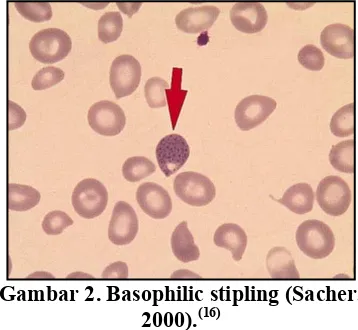 Gambar 1. Hemoglobin (Sacher, 2000). (16)  