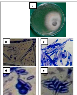 Gambar 6. (a). koloni Fusarium solani yang tumbuh di PDA dengan umur 18 hari;(b). hifa;(c)