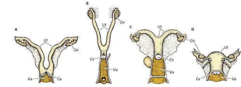 Gambar 4.  Berbagai macam tipe uterus. (A)Duplex. (B)Bipartitus. (C)Bicornuatus. (D)Simplex