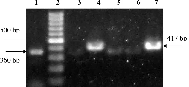 Gambar 2  Hasil amplifikasi sampel DNA Crinivirus dari lapangan dengan menggunakan metode RT-PCR