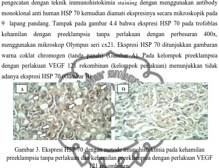 Gambar 3. Ekspresi HSP 70 dengan metode imunohistokimia pada kehamilan preeklampsia tanpa perlakuan dan kehamilan preeklampsia dengan perlakuan VEGF 