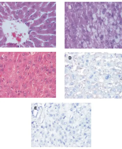 FIGURE 1.A: Control group showing normal hepatocytes (Group I). B and D: FeSO4 administered by feed and CCl4 administered bygavage (5 days per week) for 3 weeks (Group II)