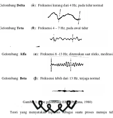 Gambar 1. Tipe gelombang EEG (Priguna, 1980) 