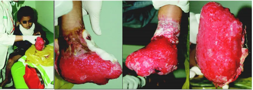 FIGURE 1. Ulcer condition in the first visit.