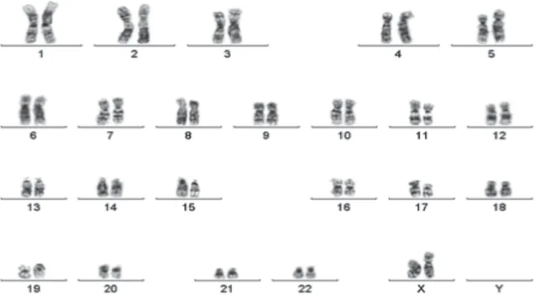 FIGURE 2. Cytogenetic analysis showed a normal karyotype