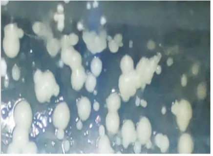 FIGURE 1.  Colony appearance of  C. albicans isolat-ed from sputum which was cultured on Sa-bouraud’s dextrose agar media, after incu-bation in room temperature for 24 hours
