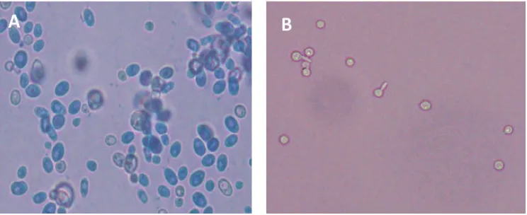FIGURE 3. Microscopic appearance of C. albicans. (A) Opaque cells appear dark, oval and polymorphic