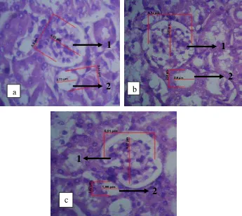 Gambaran hasil pengukuran diameter glomerulus dan diameter tubulus proksimal 