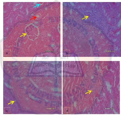 Gambar 6. Histologi ginjal tikus dengan perbesaran 400x (a) tikus normal, (b) nekrosis epitel tubulus, (c) degenerasi hidropik epithel tubulus, dan (d) nefritis interstitialis  
