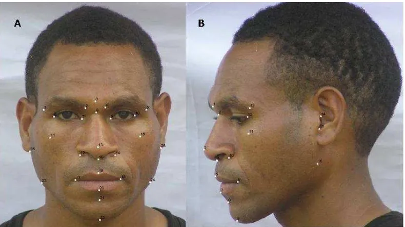 Gambar 1. Titik anatomi wajah (A) tampak depan dan (B) tampak samping 