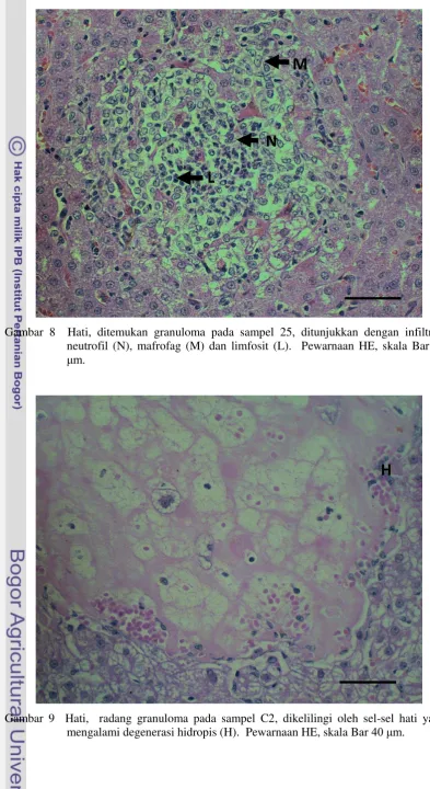 Gambar 9  Hati,  radang granuloma pada sampel C2, dikelilingi oleh sel-sel hati yang mengalami degenerasi hidropis (H)