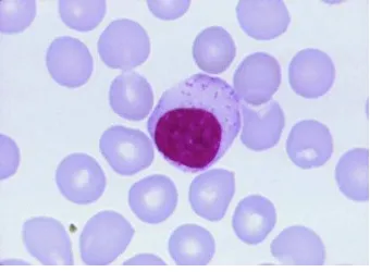 Gambar 2.1: Gambaran limfosit di antara eritrosit  pada sel darah normal (Thomas,2003) 