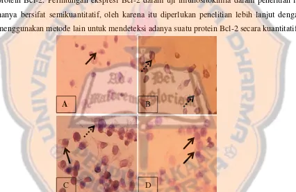 Gambar 4. Efek ekstrak metanol daun rosemary dan cisplatin dalam menekan ekspresi Bcl-2 pada sel kanker serviks HeLa